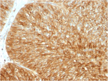 B2M Antibody
