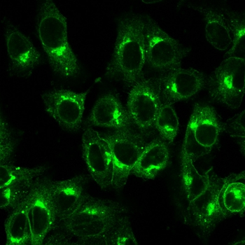 B2M Antibody