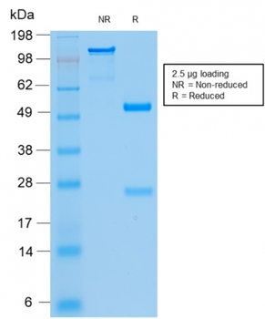 KRT8 Antibody