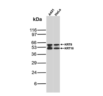 KRT8 Antibody