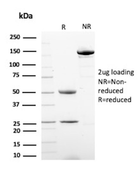 KRT8 Antibody