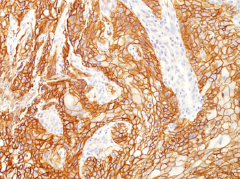 EGFR Antibody