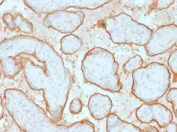 EGFR Antibody