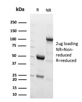 EGFR Antibody