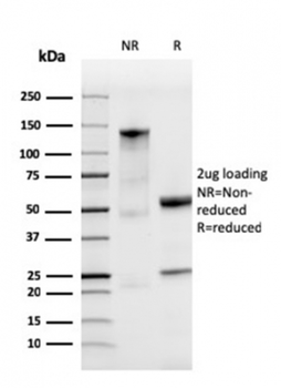 FTL Antibody