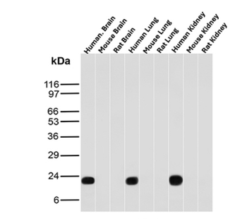 FTL Antibody