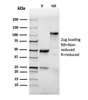 ITGAE Antibody