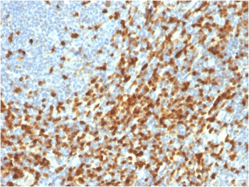 ZAP70 Antibody