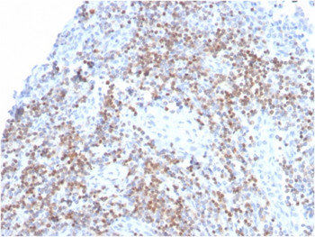 ZAP70 Antibody