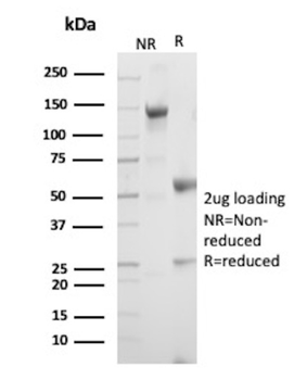 ZAP70 Antibody