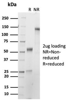 ZAP70 Antibody