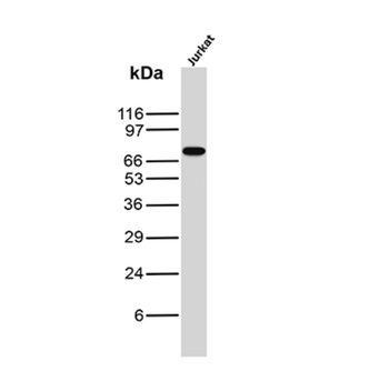 ZAP70 Antibody