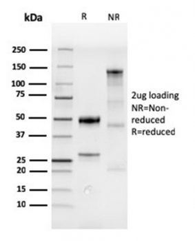 CDX2 Antibody