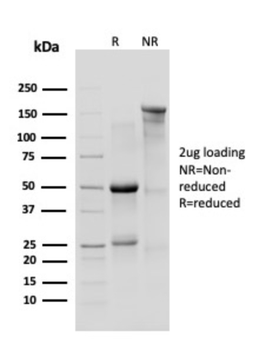 CTNND1 Antibody