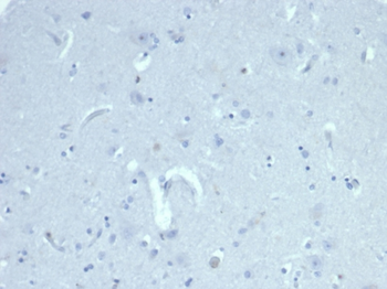 AMH Antibody