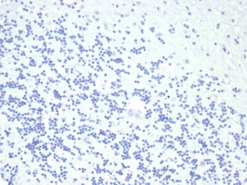 GH1 Antibody
