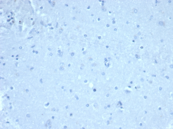 FOXP1 Antibody