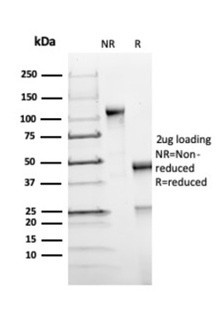 FOXP1 Antibody