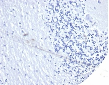 CD274 Antibody