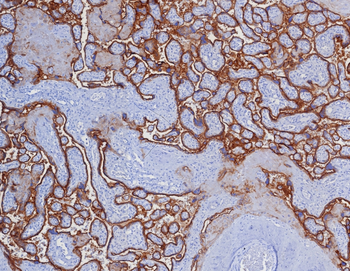 CD274 Antibody