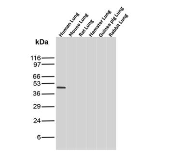 CD274 Antibody