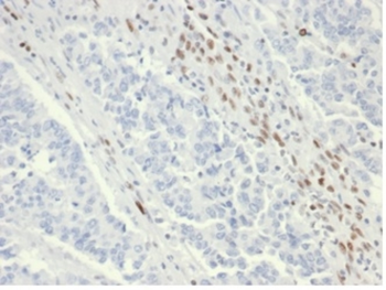 MSH6 Antibody