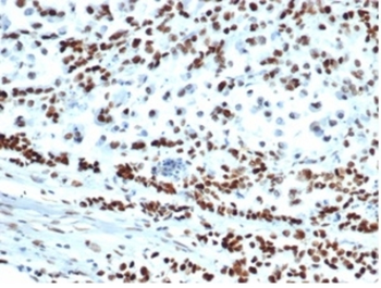 MSH6 Antibody
