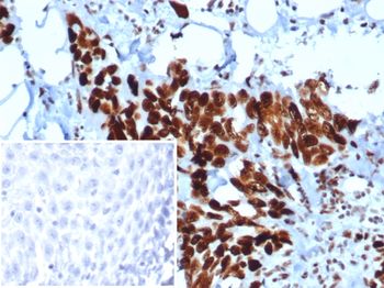 MSH6 Antibody