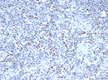 MSH6 Antibody