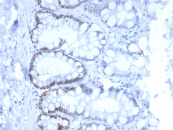 MSH6 Antibody