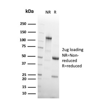 MSH6 Antibody