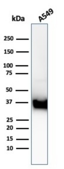 ANXA1 Antibody