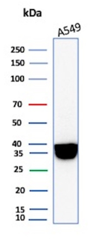 ANXA1 Antibody