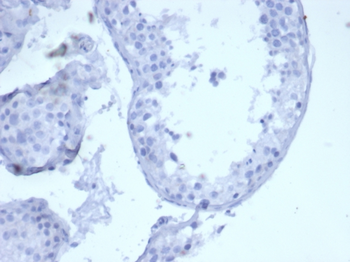 KRT5 Antibody