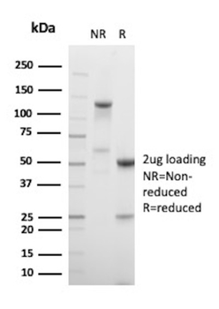 KRT5 Antibody