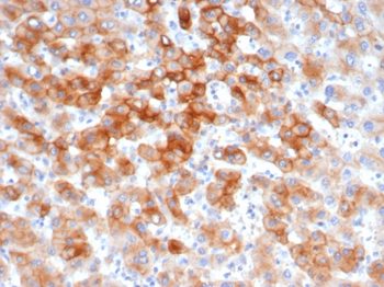 KRT8 Antibody