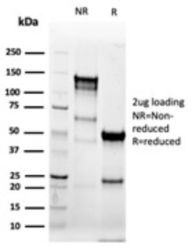 KRT8 Antibody