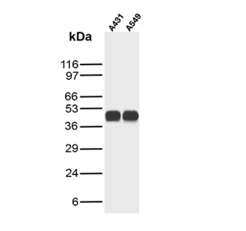 KRT8 Antibody