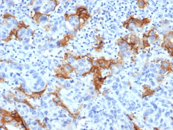 TACSTD2 Antibody