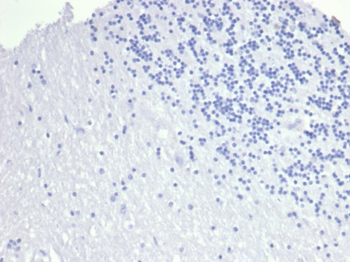 TACSTD2 Antibody
