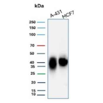 TACSTD2 Antibody