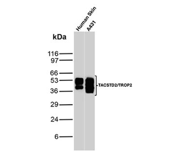TACSTD2 Antibody