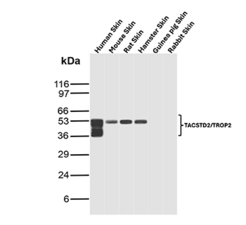 TACSTD2 Antibody