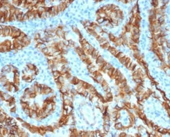 TACSTD2 Antibody