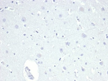 TACSTD2 Antibody