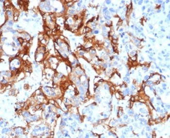 TACSTD2 Antibody
