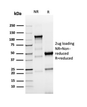 TACSTD2 Antibody