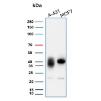 TACSTD2 Antibody
