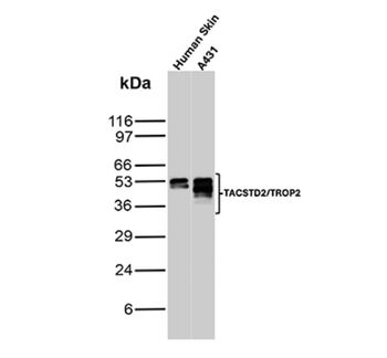 TACSTD2 Antibody