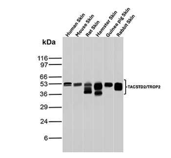 TACSTD2 Antibody